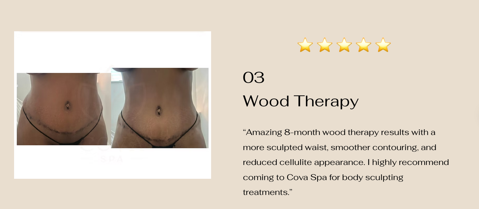 Wood Therapy body sculpting results — before and after at Cova Spa